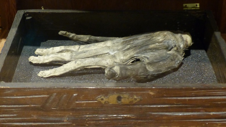 Hand of Glory at Whitby Museum
