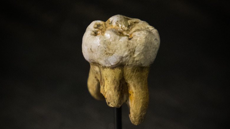 Denisovan molar tooth