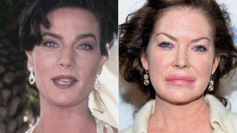 lara flynn boyle before and after surgery