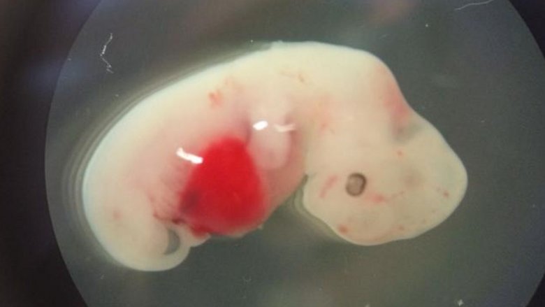 Human-pig embryos
