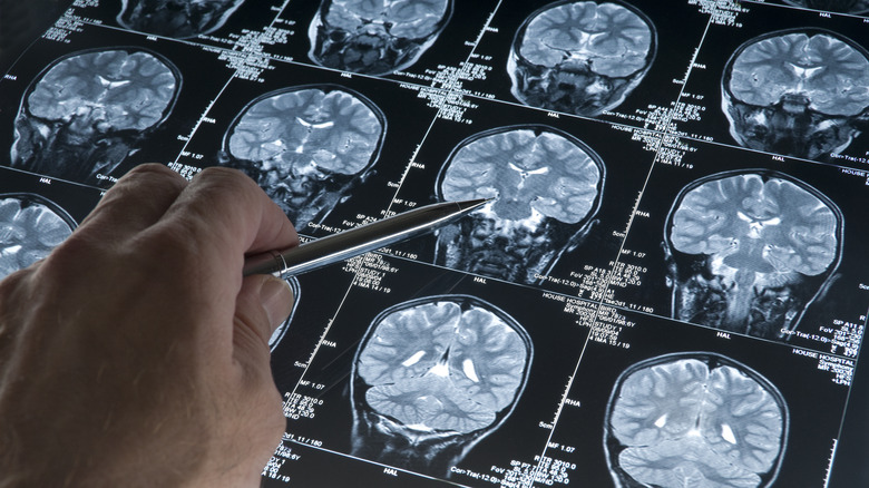 skull and brain imaging