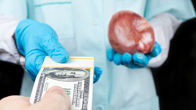 Trading money for a human heart 