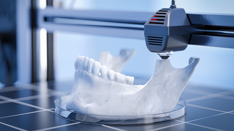 A 3-D printer printing a human jawbone with teeth