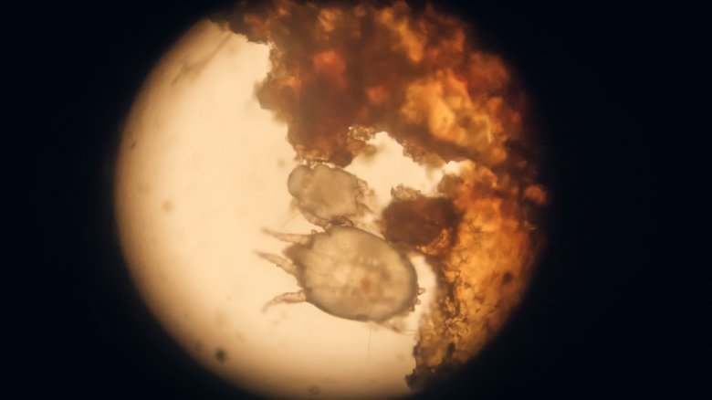 scabies under microscope