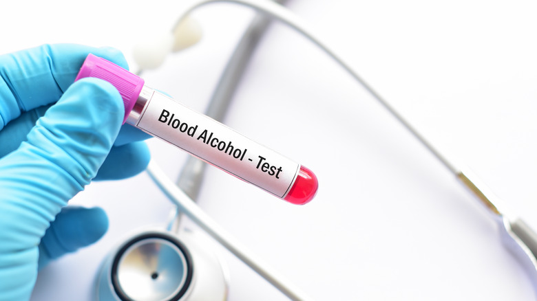 Blood alcohol test tube 