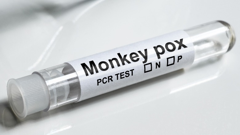Monkeypox PCR test tube