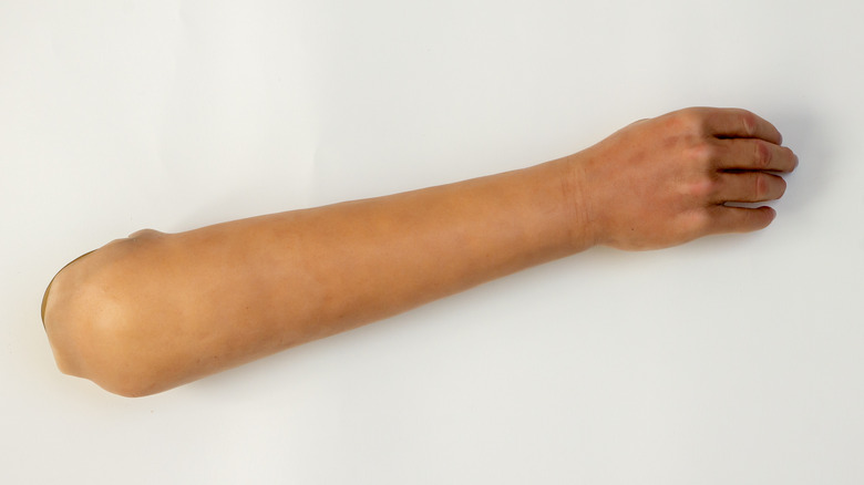Prosthetic limb including elbow