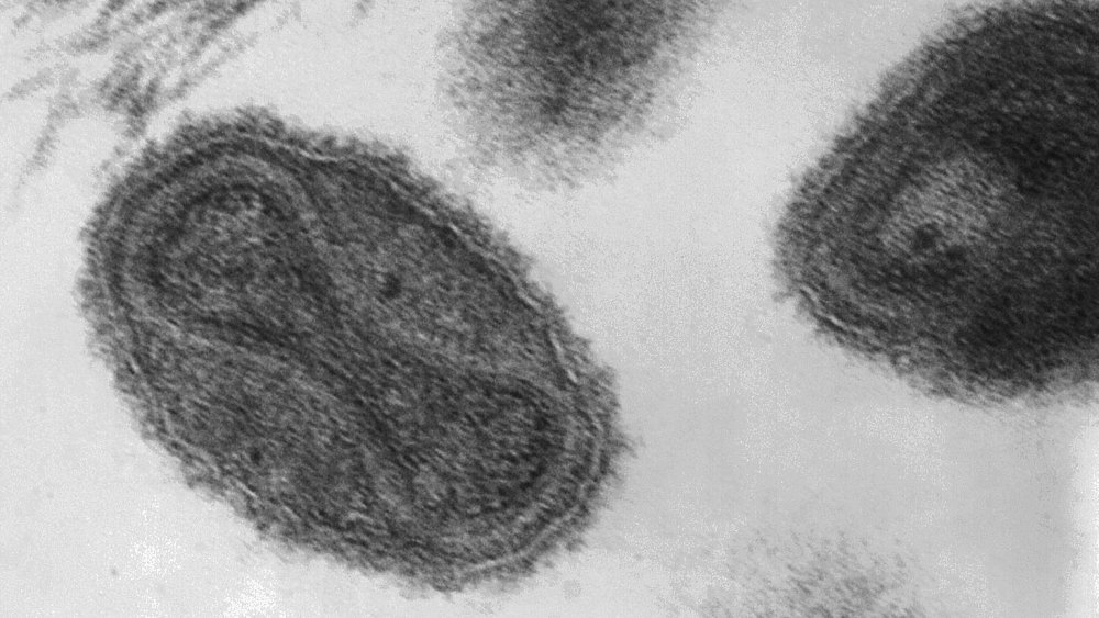 Smallpox virus virions