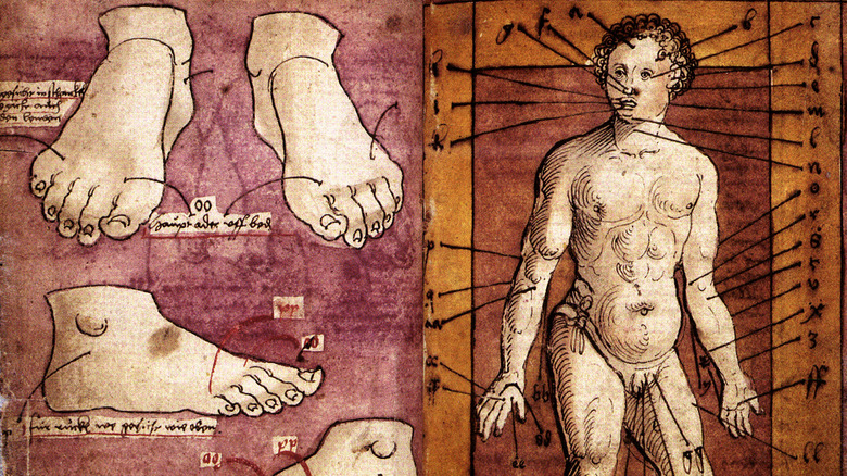  Bloodletting from a German Medical Manuscript