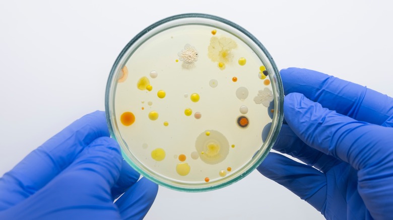 bacteria in a petri dish