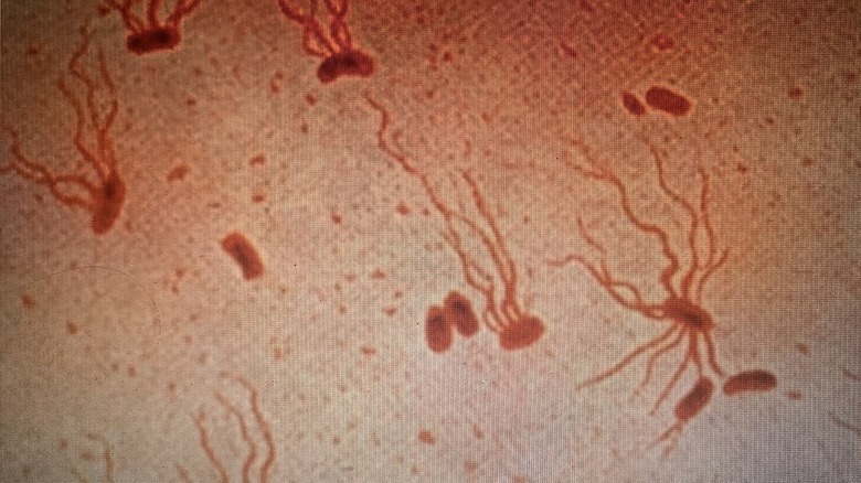 Image of Salmonella Typhi bacteria